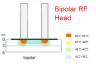 Elight + macchina bipolare di depilazione di rf con imbianca la pelle del corpo